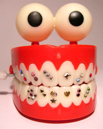 teeth model with bling