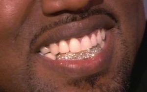 kanye diamond teeth